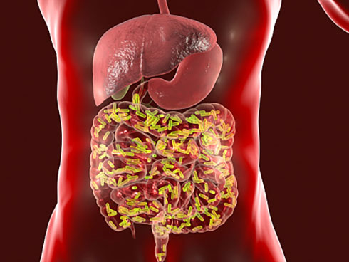 Small Intestinal Bacterial Overgrowth-Indigestion-Causes-Diagnosis-Treatment-Best-Homeopathic-Gastroenterologist-in-Pakistan-Dr.-Qaisar-Ahmed-Al-Haytham-clinic-Risalpur