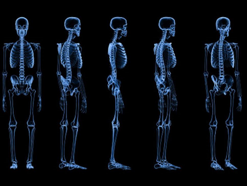 Modernizing Our Approach to Skeletal Health