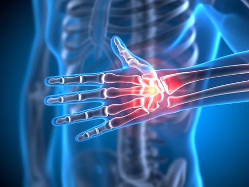 Update on Osteoporosis: Treatment and Prevention webinar