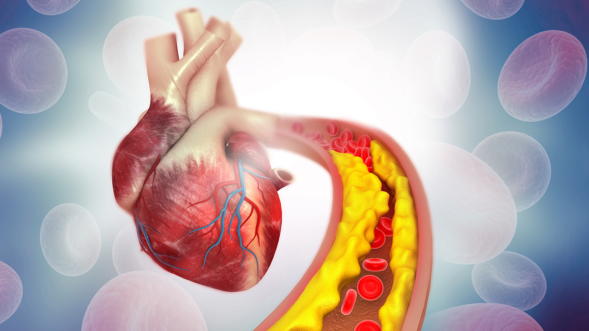 Nutrition Interventions for Dyslipidemia Across the Lifespan for the Prevention of Atherosclerotic Cardiovascular Disease